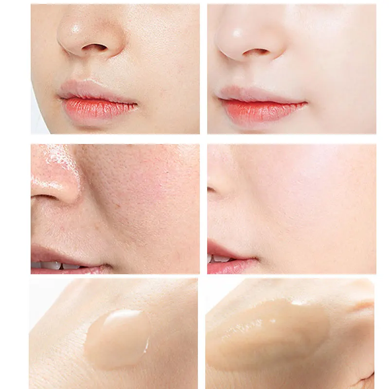Peeling Serum Salicylic Acid F - Niacinamide Pore Shrinking Essence บทวิจารณ์และราคา